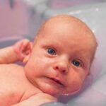 What Is Cradle Cap In Babies Caused By?